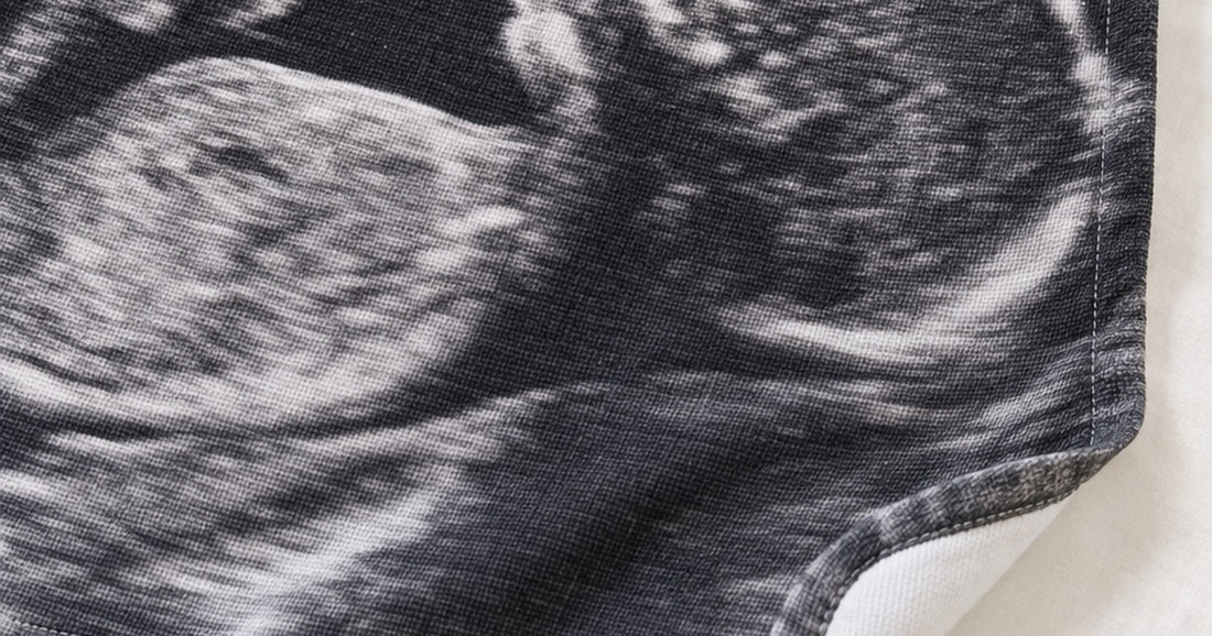 Close view of an ultrasound photo printed across one side of a custom baby swaddle blanket.